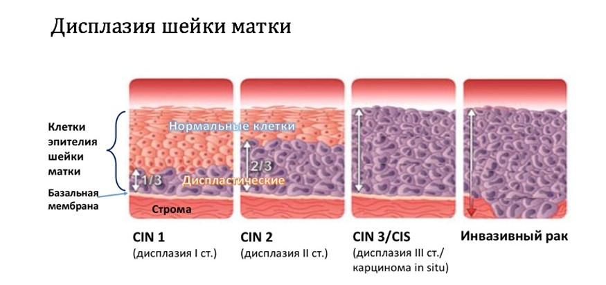 Стволовые клетки для лечения заболеваний суставов в Барнауле